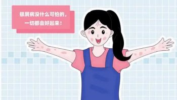 为什么会突然得牛皮癣